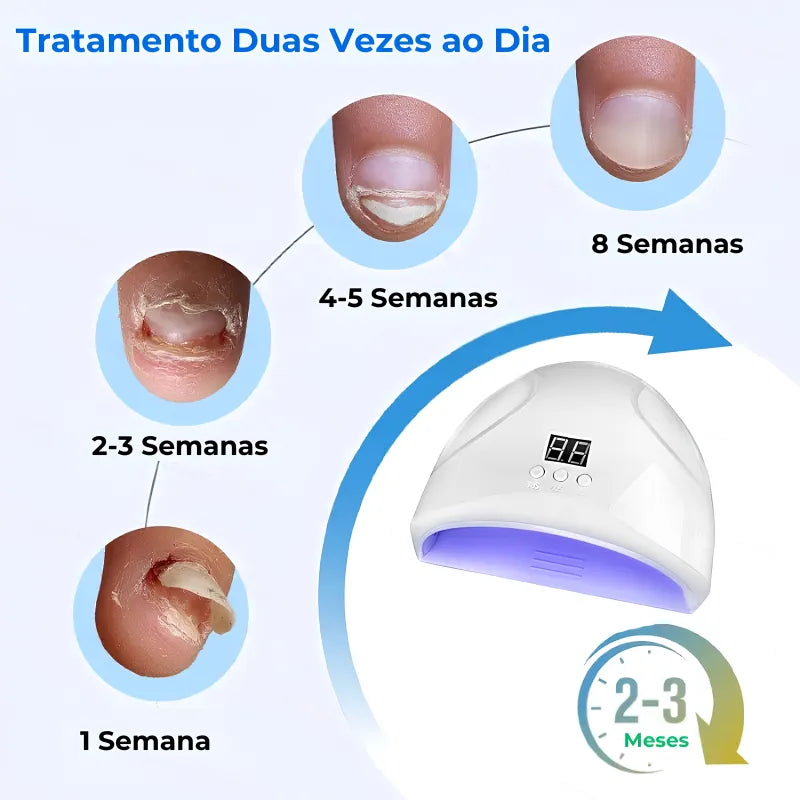 Dispositivo Laser Funcional Para Unhas