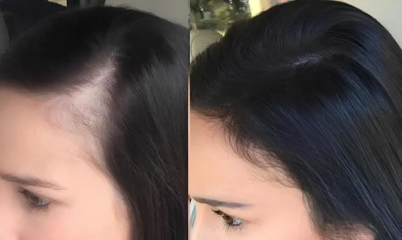 Paralisa a Queda e Acelera o Crescimento Capilar - Growth Hair